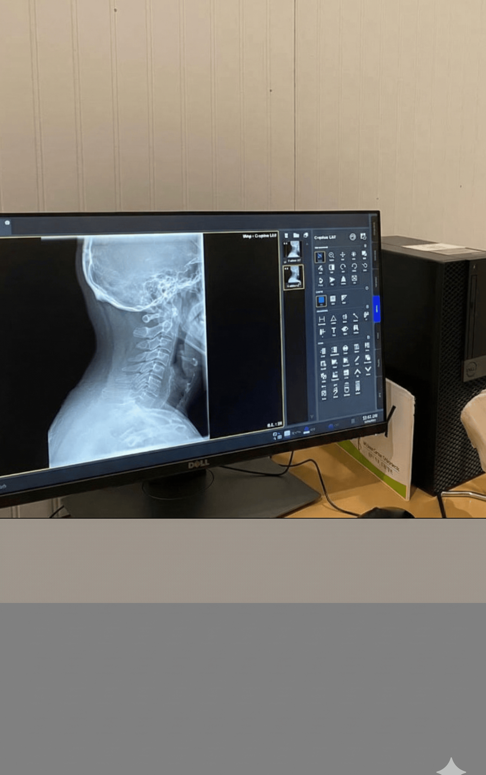 Digital X-ray diagnostic room