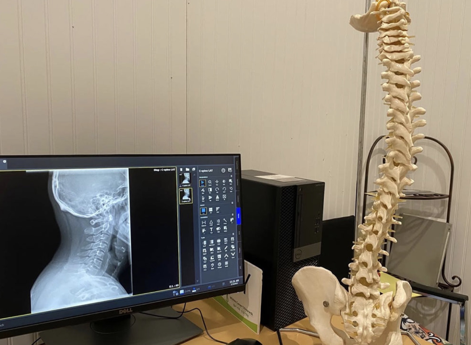 Herniated disc X-ray